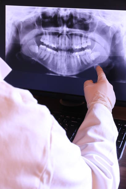 Best Emergency Dental Care for Broken or Chipped Teeth in Greentown, OH